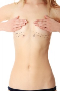 Image - Breast Augmentation vs. Breast Lift