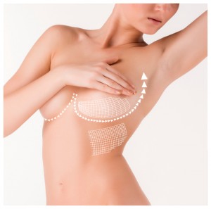 Image - 8 Reasons to Get a Breast Lift